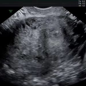 Meet your Posher, Raven